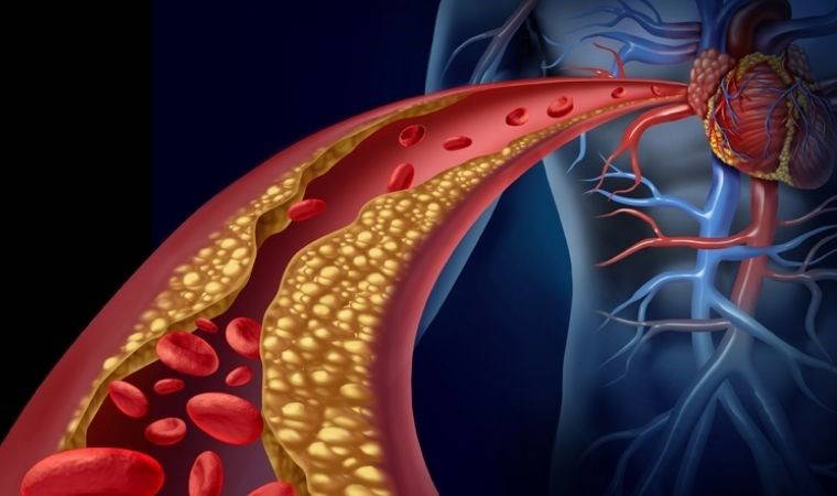 Hareketsiz yaşam atardamar sertleşmesini artırabiliyor