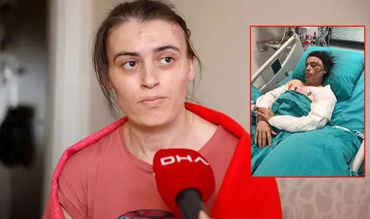 Eltisini bıçaklayıp kaynar suyla yakmıştı: 'Akıl hastası' çıktı