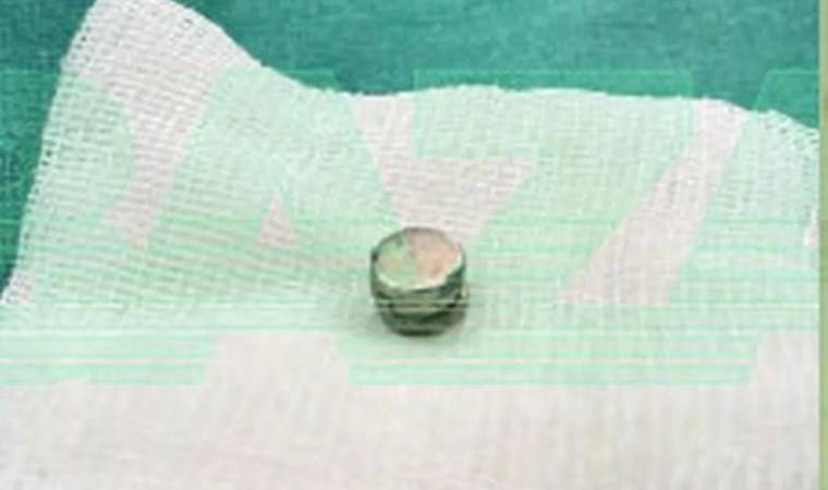 Penisine üç mıknatıs yerleştirdi...