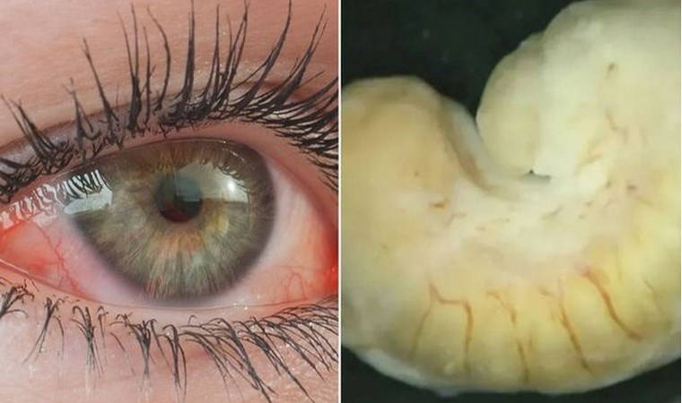 Doktorlar dehşete düştü...