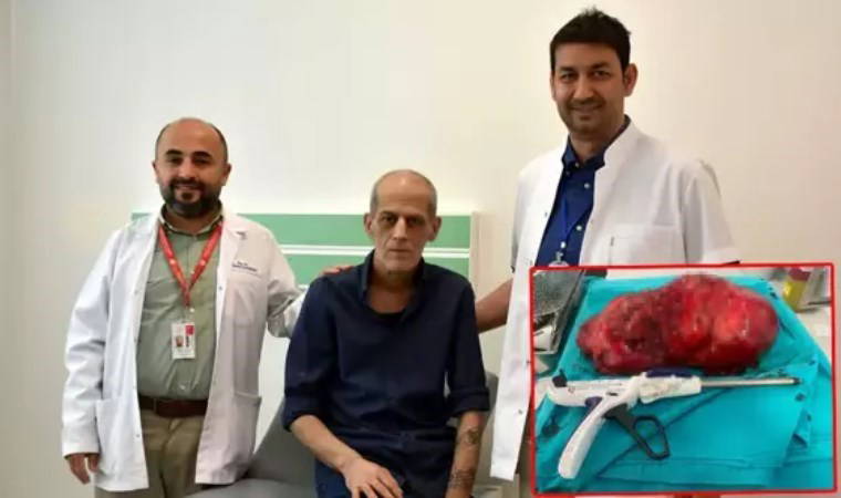Ağrıyla gitti, 8 kiloluk tümör çıkarıldı!