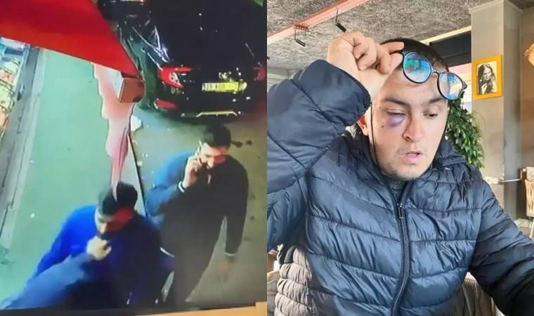 İstanbul’da dehşet: Engelli gence yumruklu saldırı!