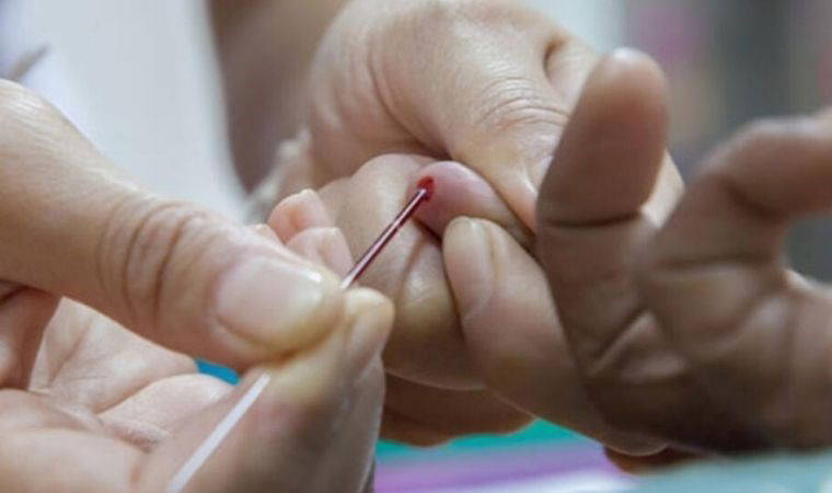 Akdeniz Anemisi (Talasemi) nedir? Akdeniz Anemisi (Talasemi) belirtileri neler?