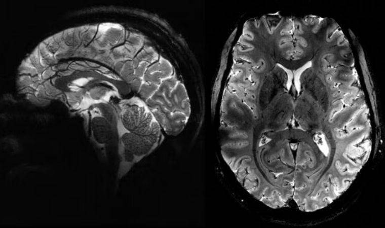 İnsan beyninin en net görüntüsü yayınlandı