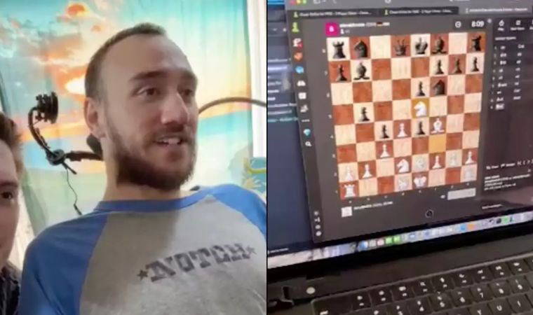 Elon Musk'ın beyin çipi, ilk kez arıza yaptı