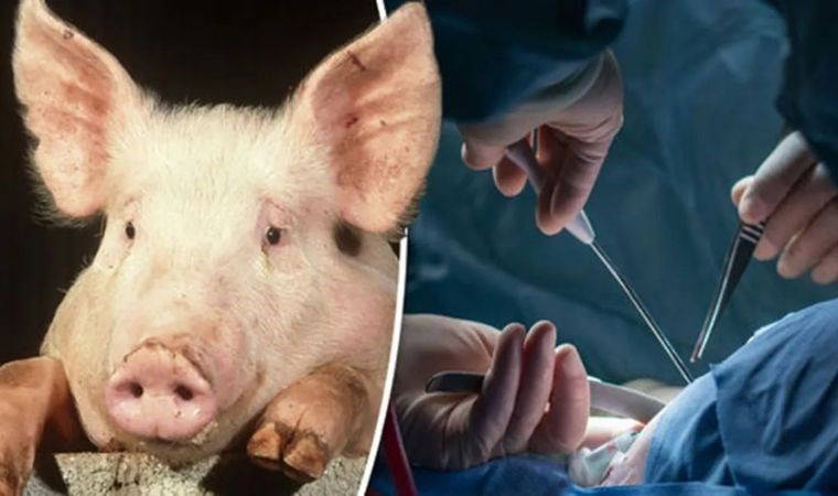ABD'de, domuz böbreği nakledilen ilk hasta hayatını kaybetti