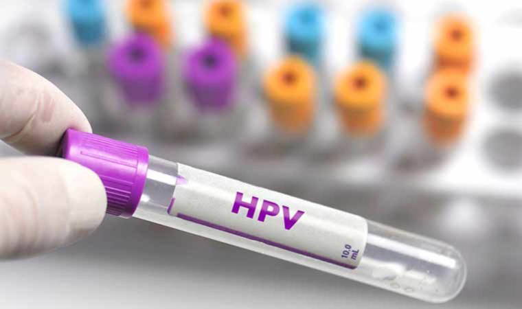 İBB ücretsiz HPV aşısı başvurusu ne zaman başlayacak? İBB ücretsiz HPV aşısı başvurusu nasıl yapılır?
