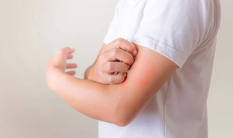 Hayalet hastalık ‘lyme’a dikkat: 300 hastalığı taklit ediyor