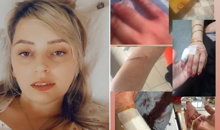 Eski eşi tarafından bıçaklanan kadın isyan etti!