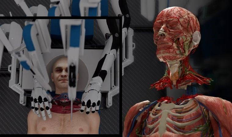 Robot cerrahisi ile kafa nakli gerçekleştirilebilir mi?