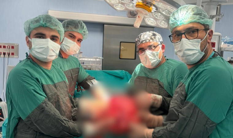 Doktorlar inanamadı... Karın ağrısıyla gelen hastanın böbreğinden 35 cm’lik kitle çıktı!
