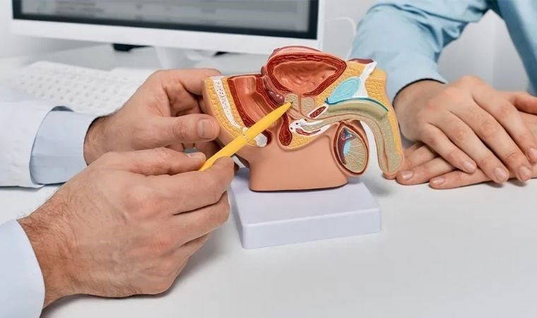 Türk bilim insanları prostatta mikroplastik buldu