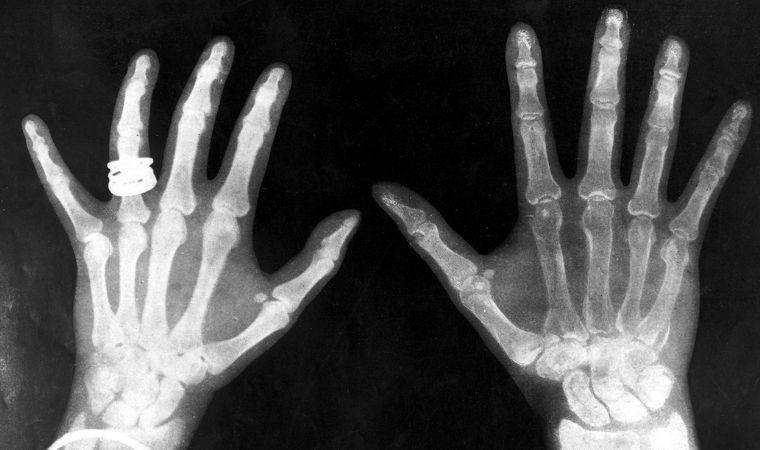 Yeni çip akıllı telefonları X-ray cihazı yapabilecek