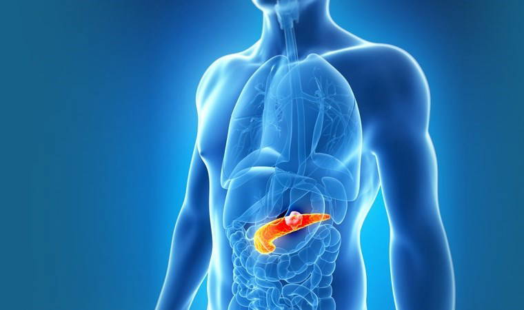 Pankreas kanseri tedavisinde yeni umut: Bilim insanları keşfetti!
