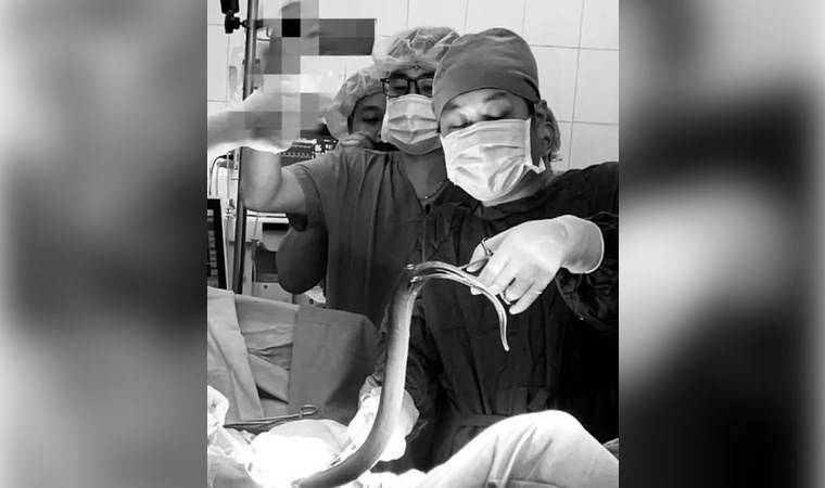 Şiddetli karın ağrısıyla hastaneye başvurdu...