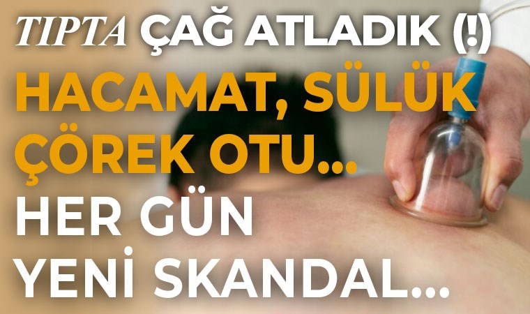 Sülük, hacamat... Alternatif tıp halk sağlığını riske atıyor