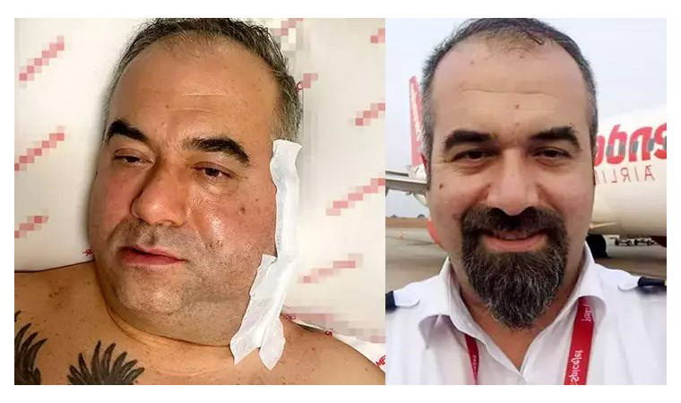 'doktor ihmali' iddiası'