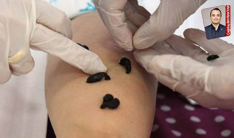 Uzmanlar: 'Ölümcül olabilir'