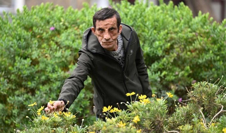 Türkiye’nin ilk yüz nakliyle hayatı değişti: Uğur Acar 13 yıldır aynalarla barışık