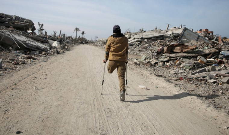 15 aylık savaşta hayatlar nasıl değişti?