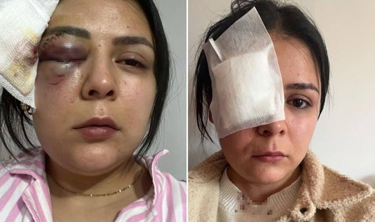 Yolda yürüyen kadına yumrukla saldırdı