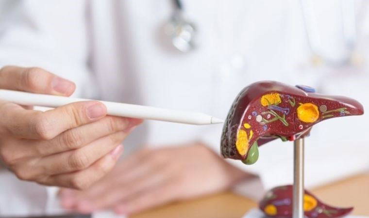 Karaciğerin dostu mucize yöntem: Karaciğer yağlanmasına iyi gelen 7 doğal çözüm