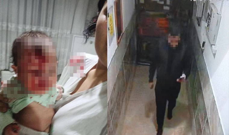 Ankara'da erkek şiddeti: 4 aylık bebeğini cam sehpaya atıp hastaneye gitmesine engel oldu!