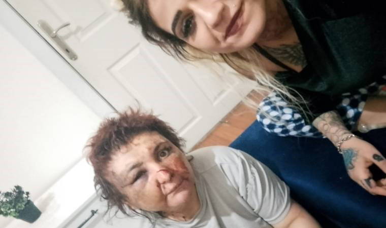 Ankara'da işkence! Alıkoyup feci şekilde darbettiler, sosyal medyada paylaştılar