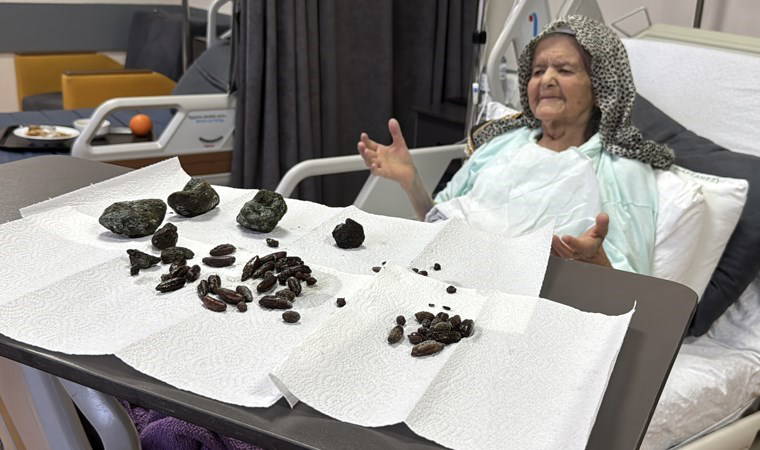 Doktorları bile şoke eden ameliyat...