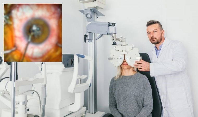 7 yıldır gözünde metal parçasıyla yaşıyordu! Ameliyatla sağlığına kavuştu!