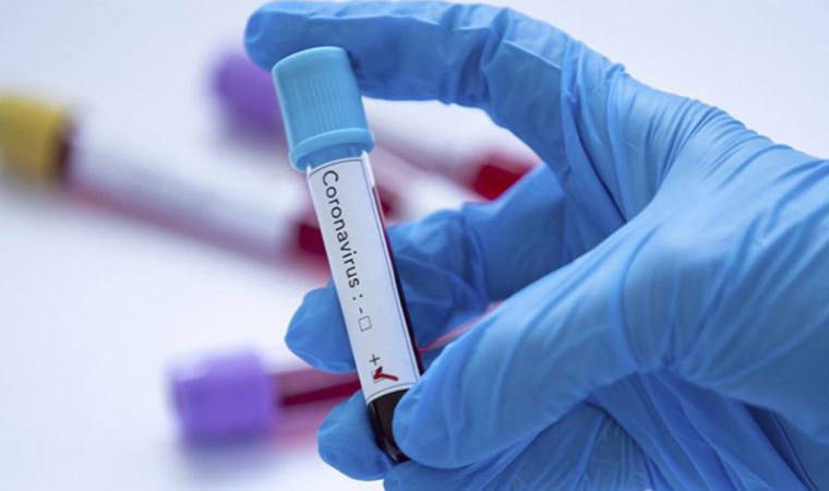 Çinli araştırmacılar, yeni tip koronavirüs keşfetti