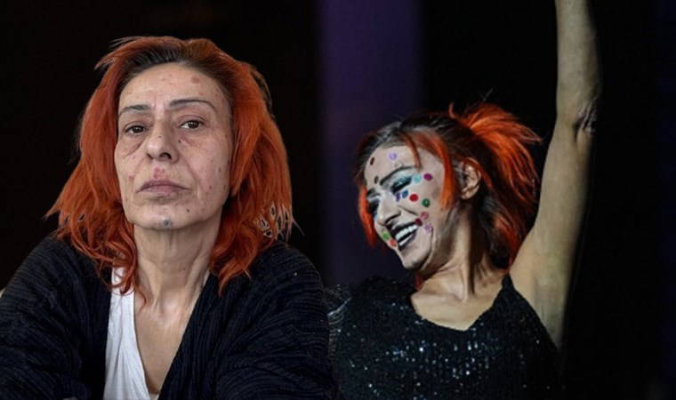 Daha önce maske takmıştı: Yüzü yanan Yıldız Tilbe şimdi de renkli beneklerle sahneye çıktı!