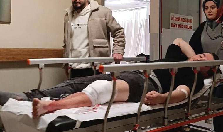 Bursa'da gece yarısı dehşet anları: Arkadaşlarıyla sohbet ederken silahlı saldırıya uğradı!