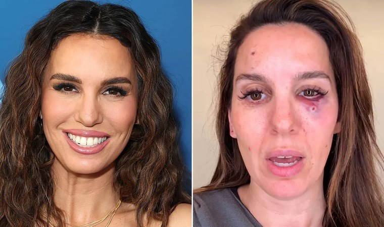 Eski Disney yıldızı Romano, ava giderken av oldu