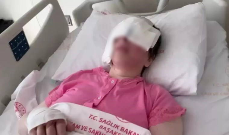 Avcılar'da reddettiği erkek tarafından kezzaplı saldırıya uğrayan kadın dehşet anlarını anlattı