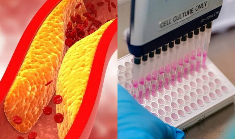 Bilim insanları geliştirdi: Kalp krizi ve felci önleyebilir