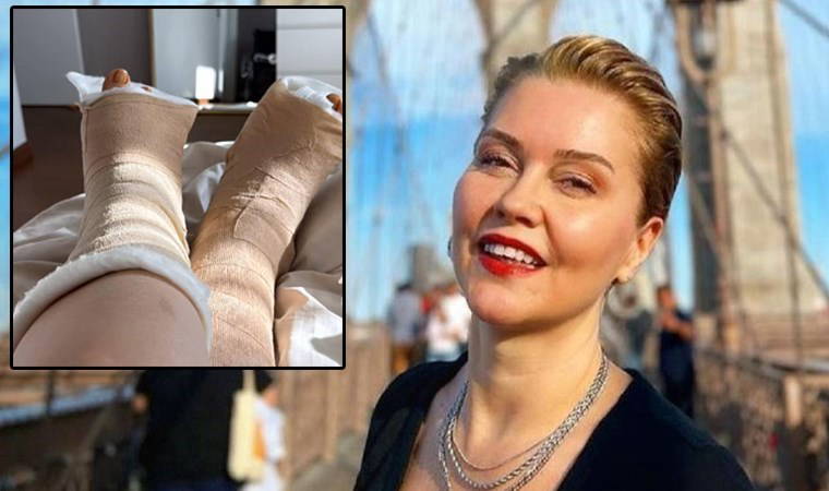 Haftalarca yürüyemeyecek... Didem Uzel'den ameliyat paylaşımı: 'Çektiğim eziyeti anlatamam'