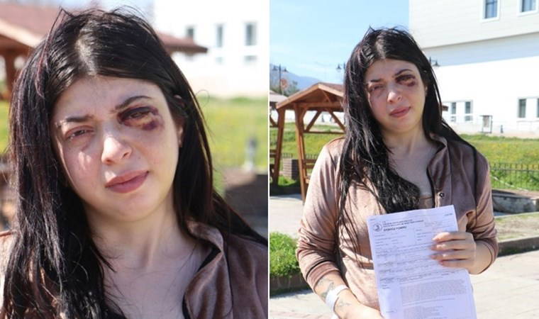 Sokak ortasında tacize uğrayıp darbedildi: '3 ay sıvı ile besleneceğim'