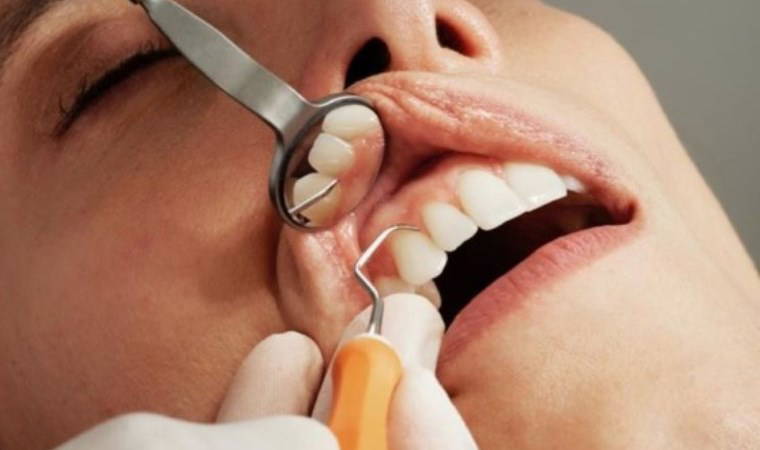 Diş çürüğü sorunu olanlar dikkat: O hastalığı tetikliyor!