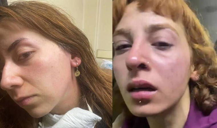 Gazetecilere polis şiddeti... DİSK Basın-İş'ten sert tepki: 'Savcıları göreve davet ediyoruz!'