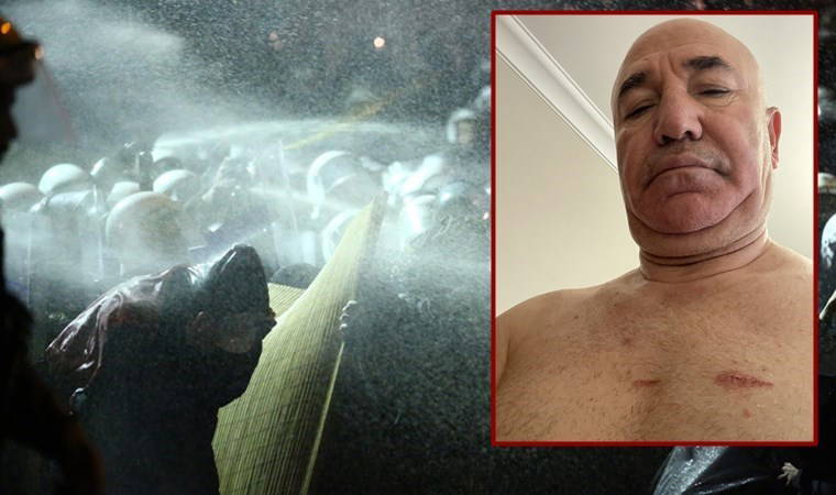 CHP'li Tanal'a polis şiddeti: 'Bu yaralar sadece bedende değil, hukuk devletinde açılmıştır'