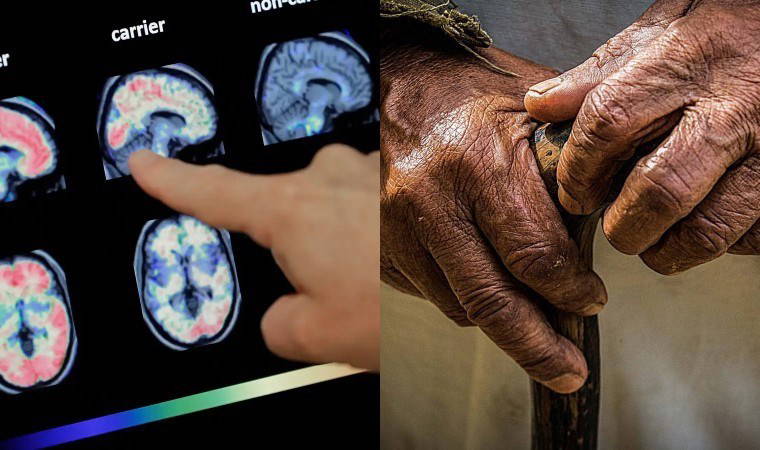 Araştırma: Beyin hangi yaşta yaşlanmaya başlıyor?