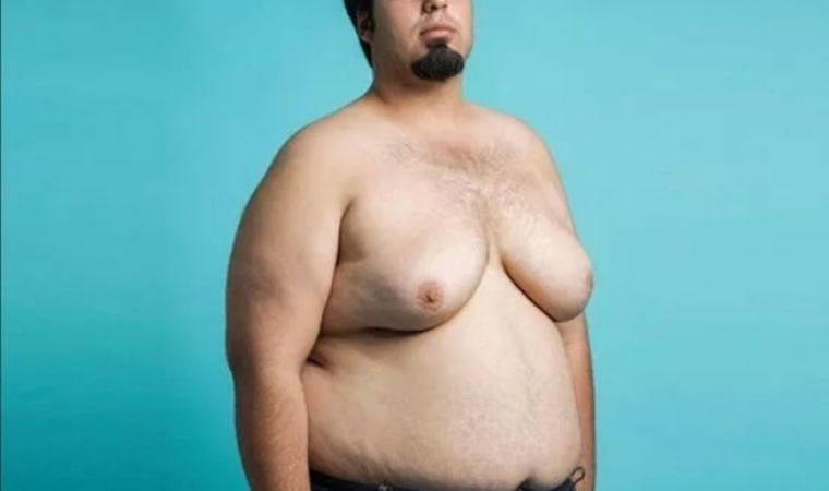 Erkeklerde kadın tipi meme büyümesi artıyor!