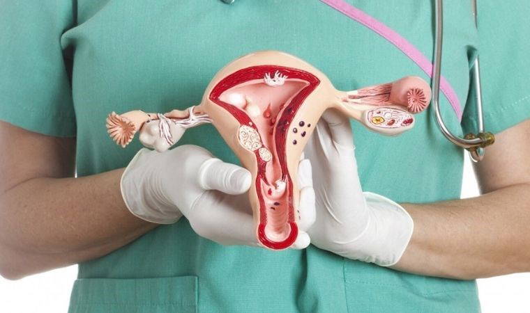 Çikolata kistleri masum değil; bağışıklık sistemi hastalıklarına yakalanmayı artırıyor