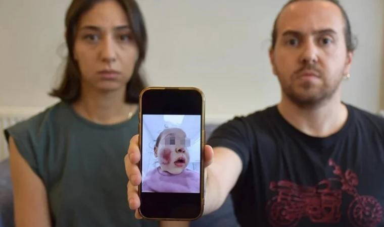 Antalya'da kreş skandalı! 2 yaşındaki bebek dakikalarca darp edildi