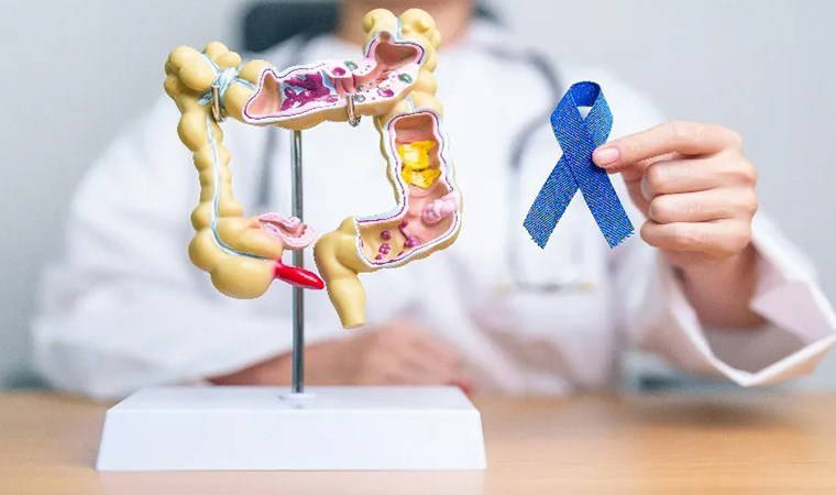 Uzmanı uyardı: 'Kolon kanseri genç nüfusta da belirgin şekilde artıyor'