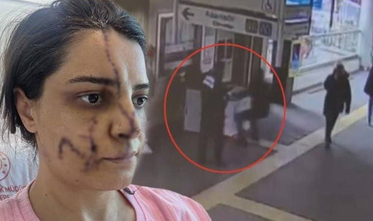 Türkiye bu olayı konuşmuştu!