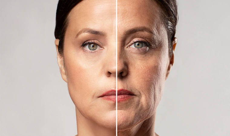 Yaşlanma izlerini önleyerek zamanı geride bırakın: Kırışıklık oluşumunu engelleyen 7 doğal yöntem