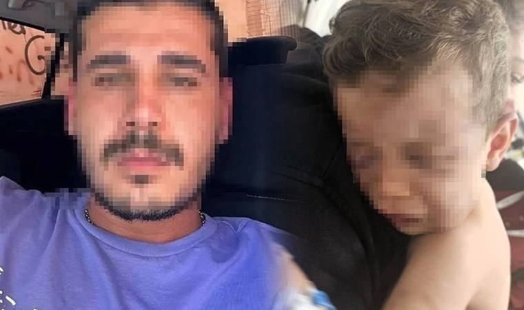 Türkiye bu vahşeti konuşuyor... 2 yaşındaki bebeği ısırdı, yakmaya çalıştı: İfadesi kan dondurdu!