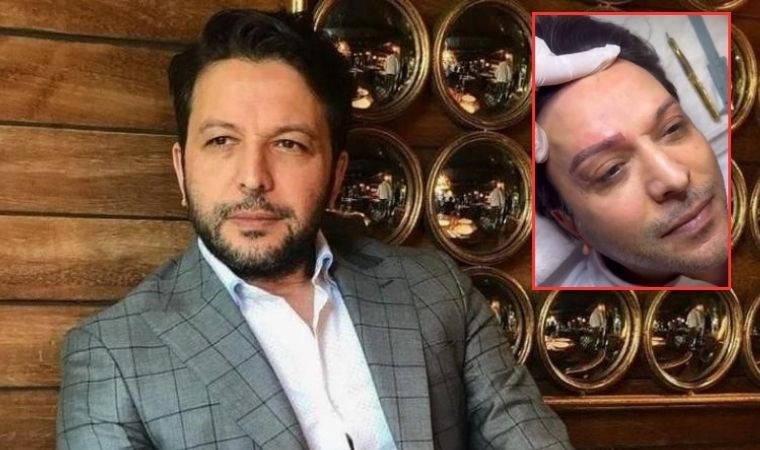 Nihat Doğan estetik yaptırdı!